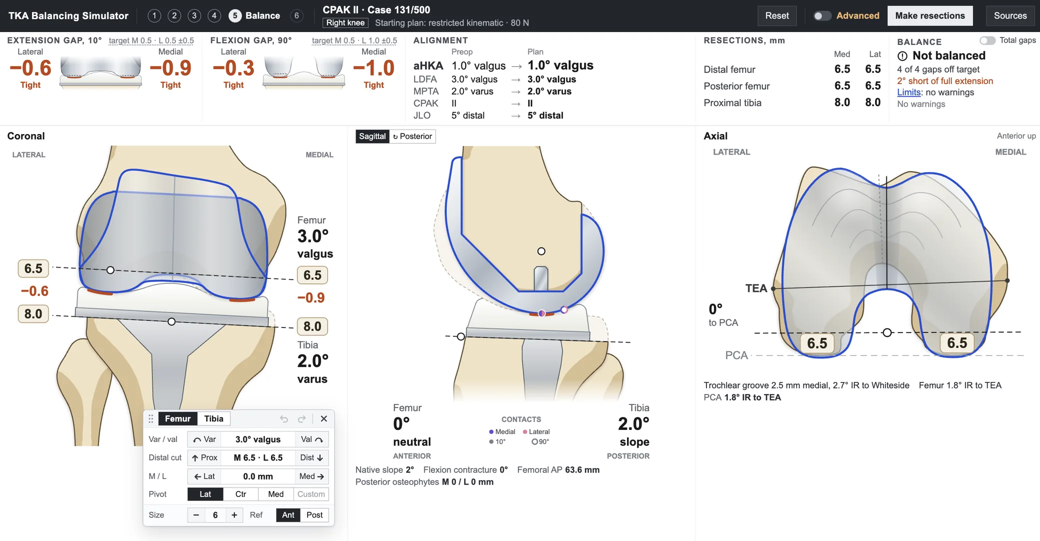 The balancing screen, with extension and flexion gaps, alignment and resections across the top and the knee in coronal, sagittal and axial views